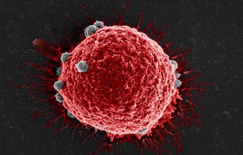 سرطان و انواع آن