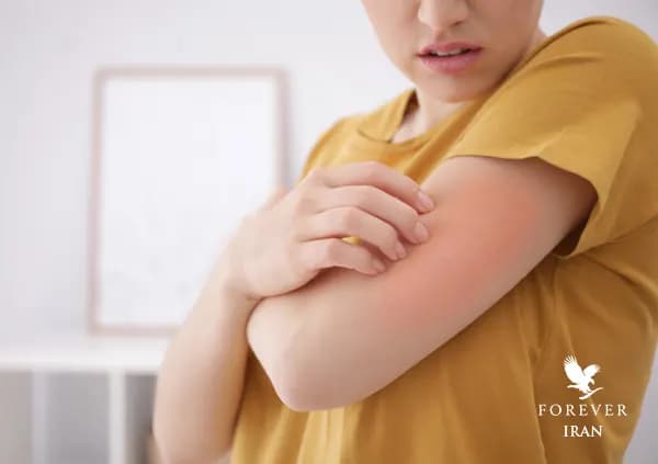 آلرژی پوستی